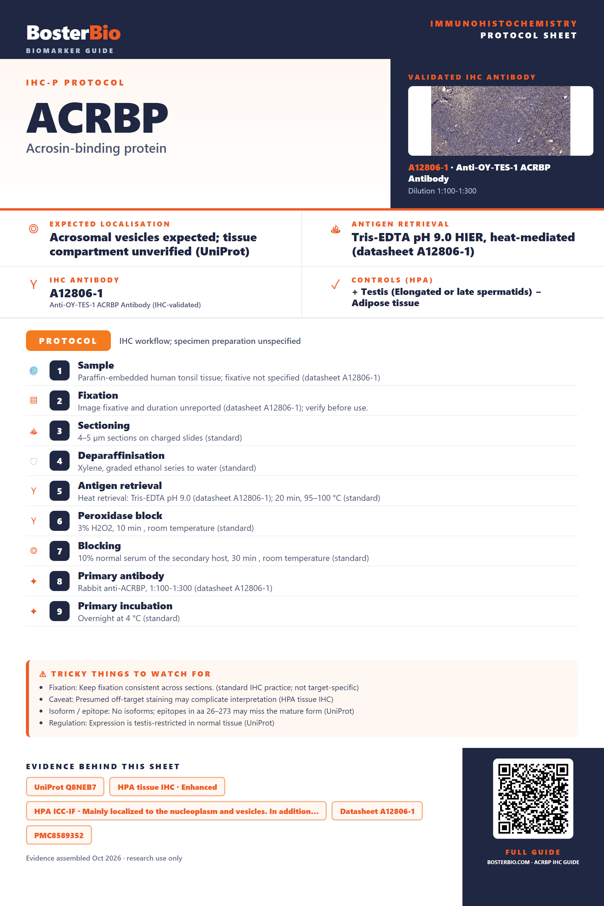Immunohistochemistry protocol sheet for ACRBP (IHC for ACRBP): expected localisation Acrosomal vesicles expected; tissue compartment unverified (UniProt), antibody A12806-1, validated IHC image, and IHC protocol steps