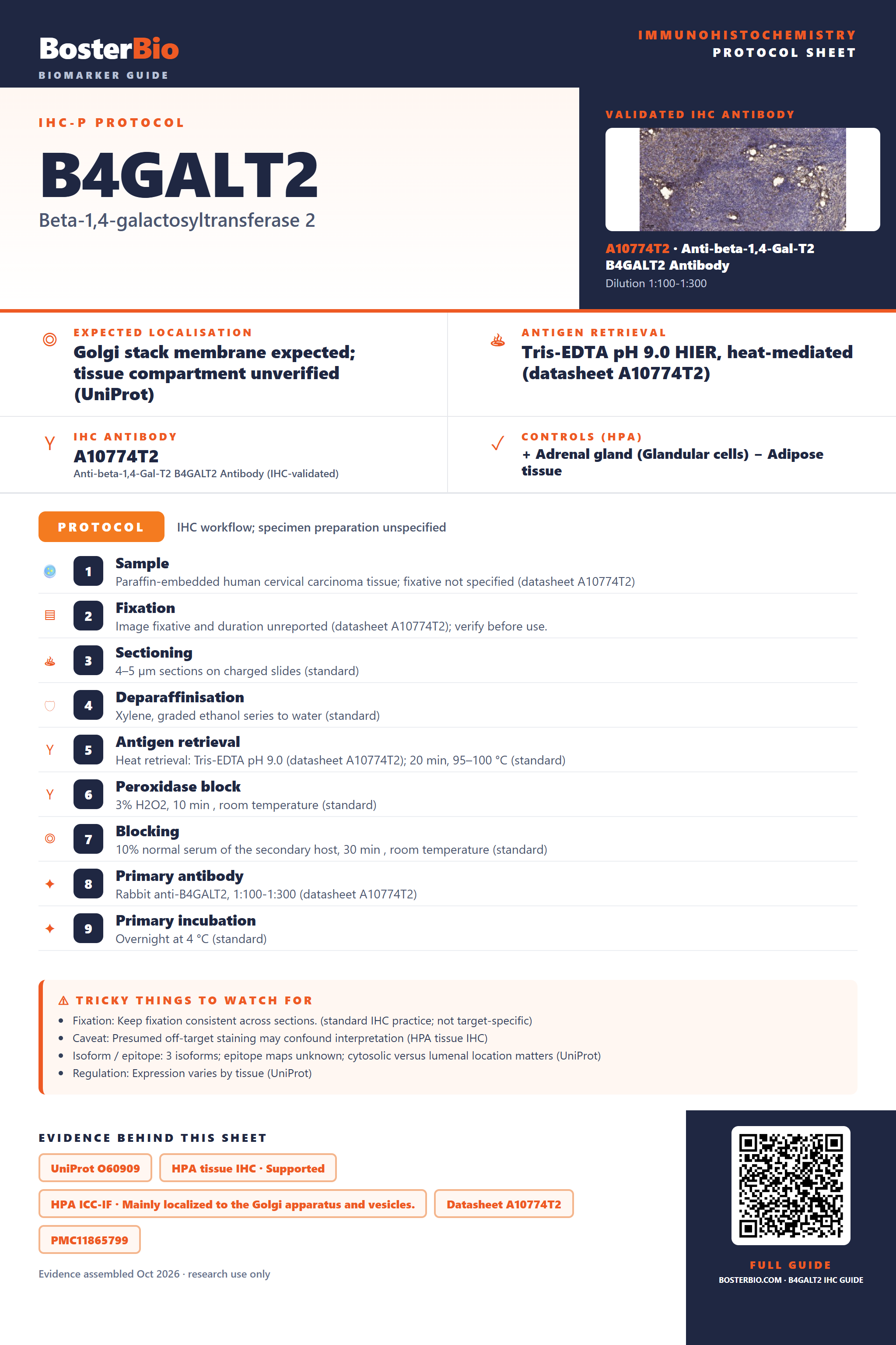 Immunohistochemistry protocol sheet for B4GALT2 (IHC for B4GALT2): expected localisation Golgi stack membrane expected; tissue compartment unverified (UniProt), antibody A10774T2, validated IHC image, and IHC protocol steps