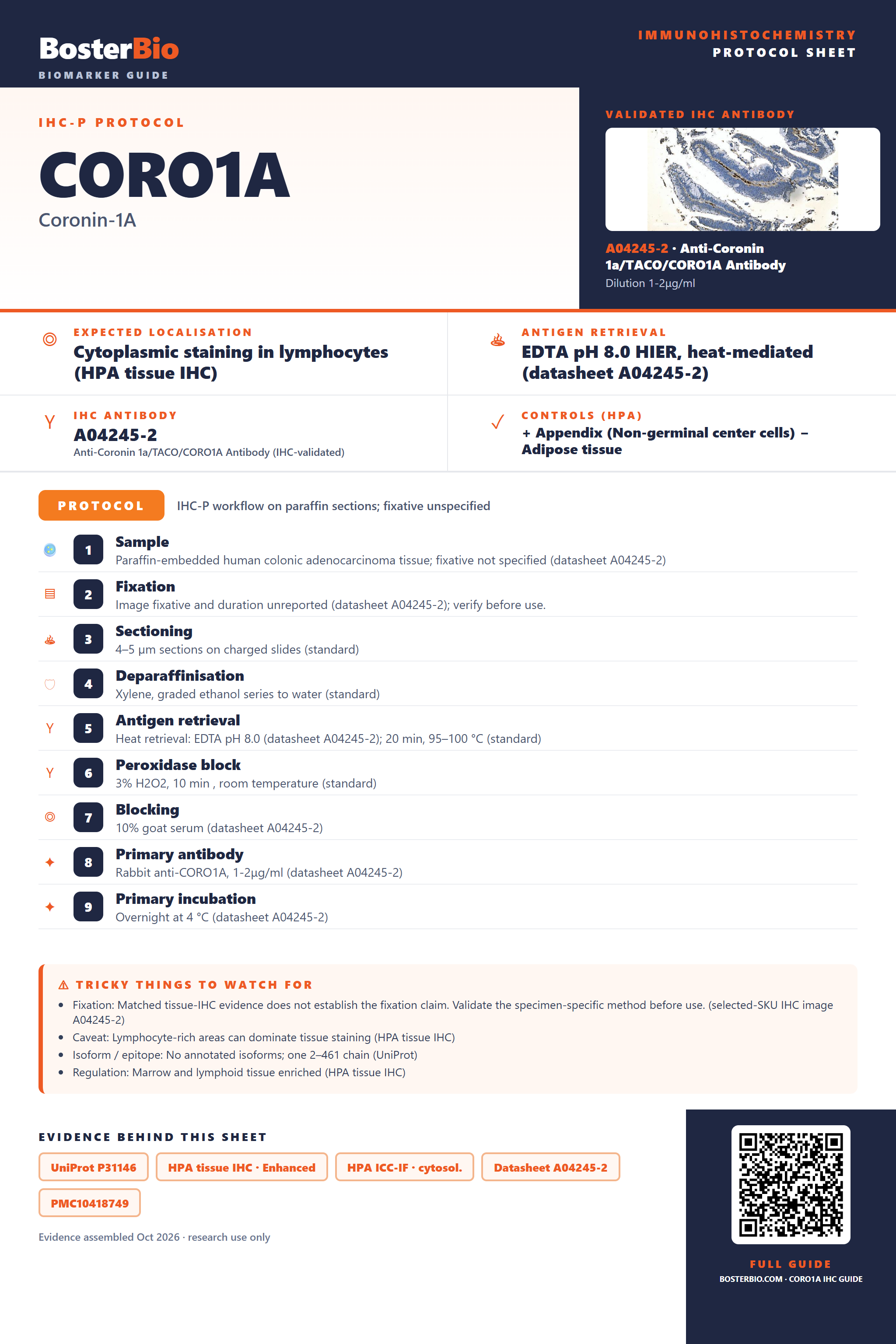 Immunohistochemistry protocol sheet for CORO1A (IHC for CORO1A): expected localisation Cytoplasmic staining in lymphocytes (HPA tissue IHC), antibody A04245-2, validated IHC image, and IHC protocol steps