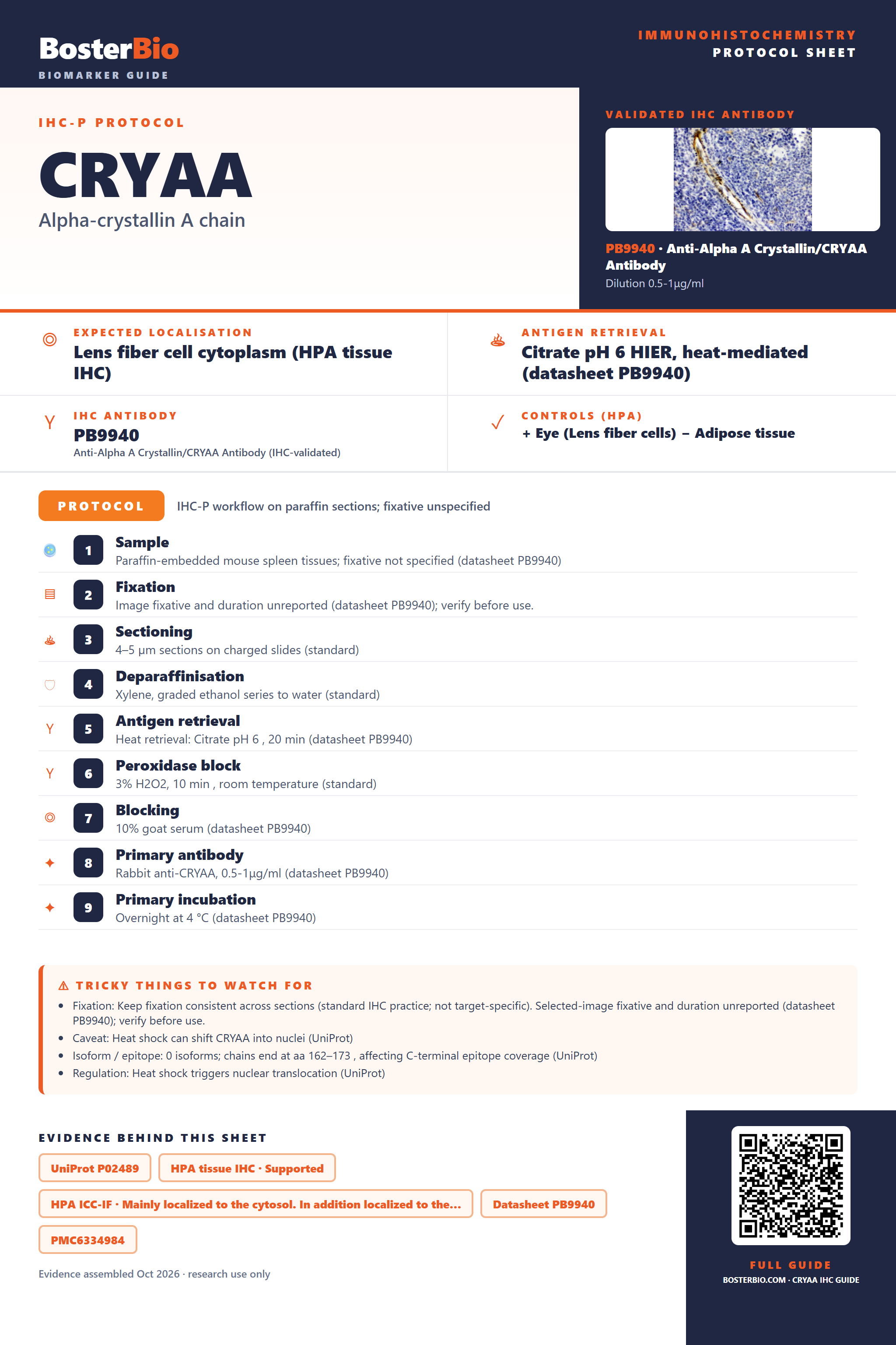 Immunohistochemistry protocol sheet for CRYAA (IHC for CRYAA): expected localisation Lens fiber cell cytoplasm (HPA tissue IHC), antibody PB9940, validated IHC image, and IHC protocol steps