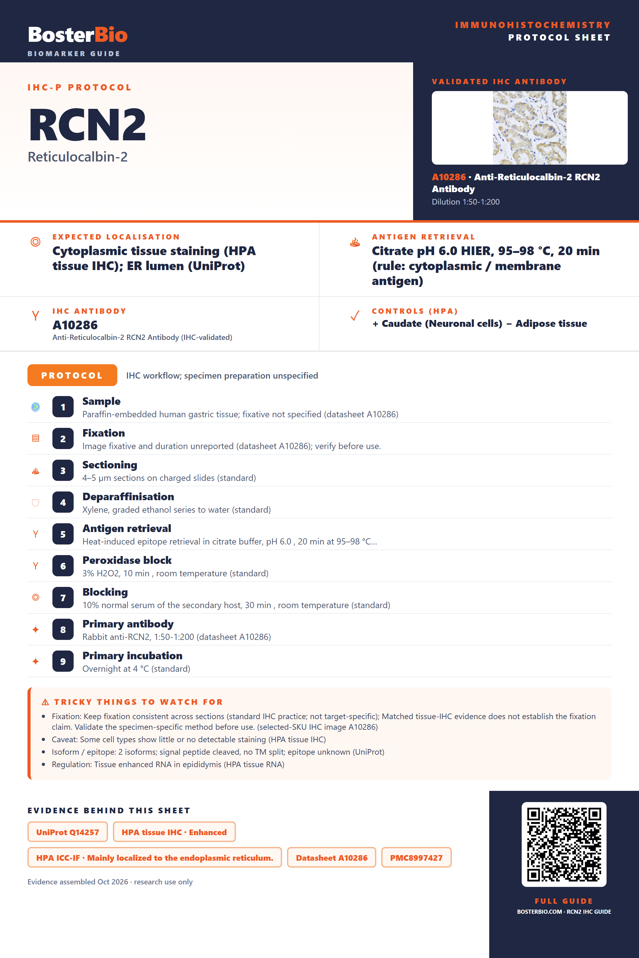 Immunohistochemistry protocol sheet for RCN2 (IHC for RCN2): expected localisation Cytoplasmic tissue staining (HPA tissue IHC); ER lumen (UniProt), antibody A10286, validated IHC image, and IHC protocol steps