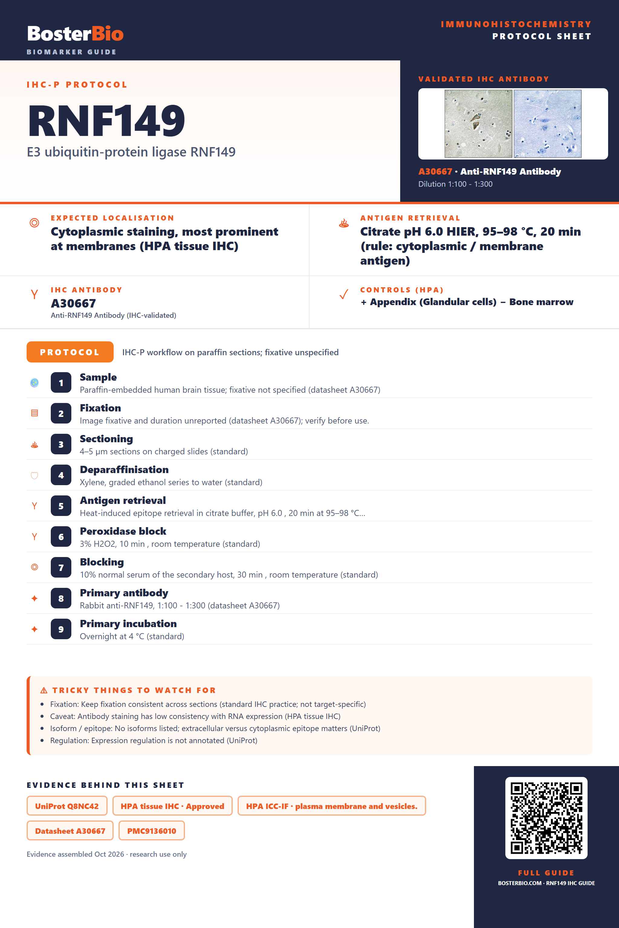 Immunohistochemistry protocol sheet for RNF149 (IHC for RNF149): expected localisation Cytoplasmic staining, most prominent at membranes (HPA tissue IHC), antibody A30667, validated IHC image, and IHC protocol steps