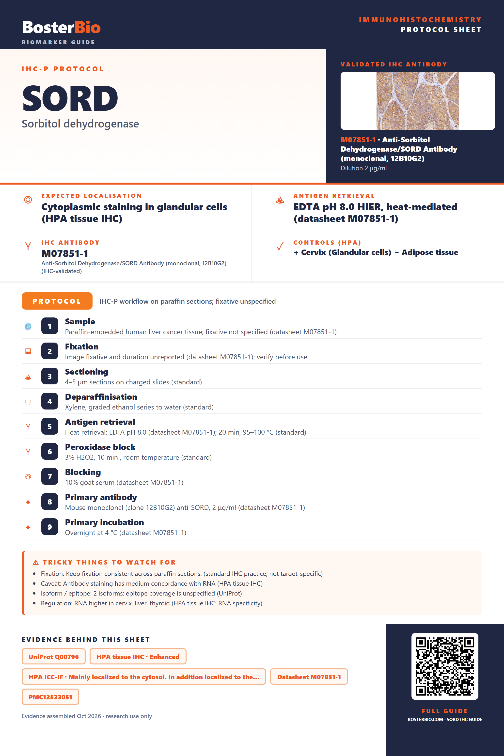 Immunohistochemistry protocol sheet for SORD (IHC for SORD): expected localisation Cytoplasmic staining in glandular cells (HPA tissue IHC), antibody M07851-1, validated IHC image, and IHC protocol steps