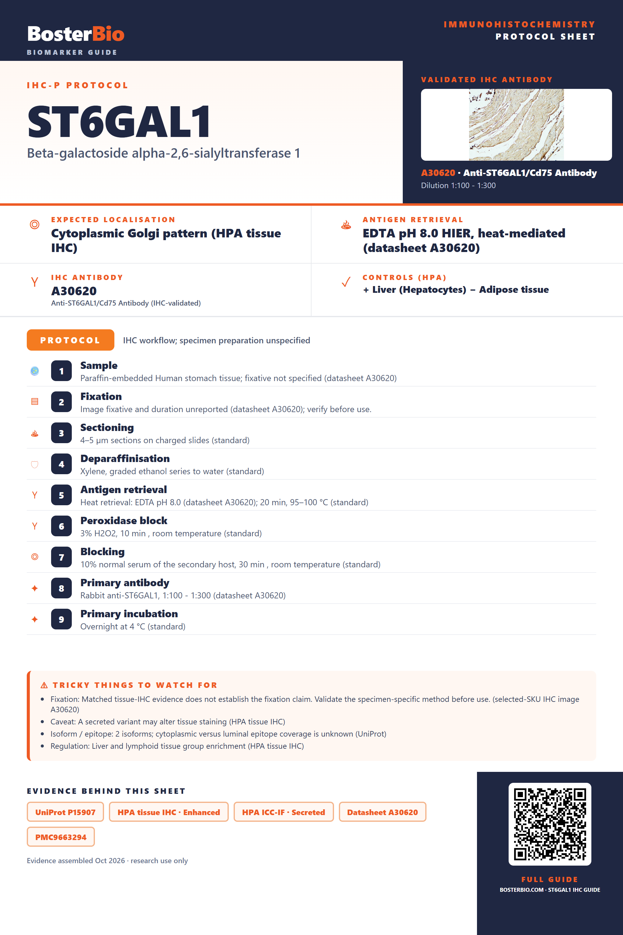 Immunohistochemistry protocol sheet for ST6GAL1 (IHC for ST6GAL1): expected localisation Cytoplasmic Golgi pattern (HPA tissue IHC), antibody A30620, validated IHC image, and IHC protocol steps